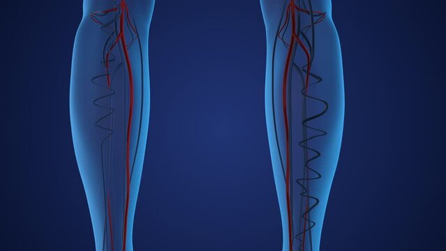 Legs with twisted enlarged varicose veins