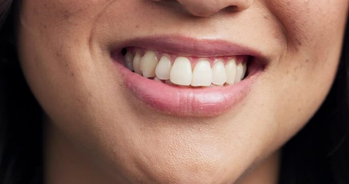 Closeup, mouth and smile of a person for dental health, dentist check or treatment. Zoom, happy and teeth or lips of a woman for braces, medical support or whitening for grooming or showing progress