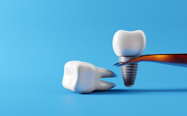 Dental teeth implants and Root caries. Oral health and dental inspection teeth. Medical dentist tool, children healthcare, 3D render