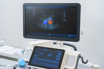 Medical ultrasound diagnostic machine is ready for work in modern hospital. High quality photo