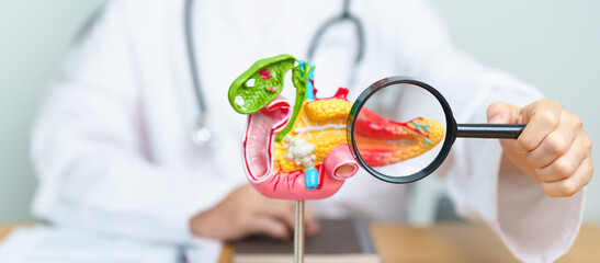 Doctor with human Pancreatitis anatomy model with Pancreas, Gallbladder, Bile Duct, Duodenum, Small intestine and magnifying glass. Pancreatic cancer, acute pancreatitis and Digestive system - obrazy, fototapety, plakaty