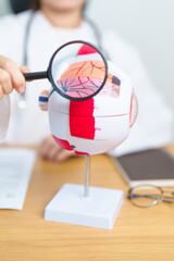 Doctor with human Eye anatomy model with magnifying glass. Eye disease, Refractive Errors, Age...