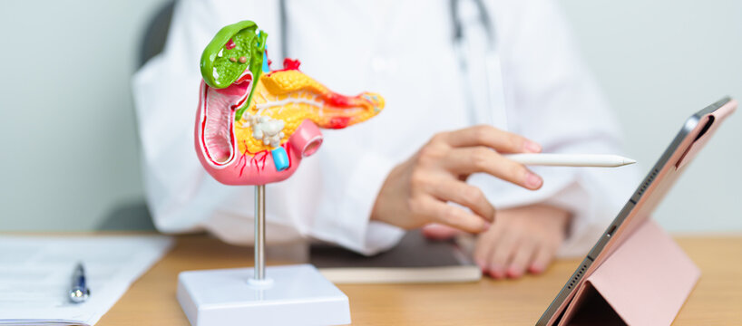 Doctor with human Pancreatitis anatomy model with Pancreas, Gallbladder, Bile Duct, Duodenum, Small intestine and tablet. Pancreatic cancer, acute pancreatitis and Digestive system