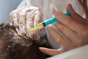 Injection plasma into head hair man cosmetologist doctor.