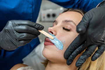 Beautician applying cosmetic gel hot sugar wax on the upper lip for removing hair in young woman