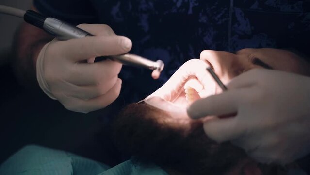 dentist refine dental restoration in patient mouth by polishing discs