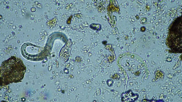 microorganisms close up under the microscope. in a soil sample from a farm
