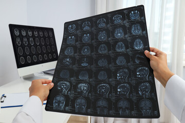MRI images of a human head in the hands of a doctor
