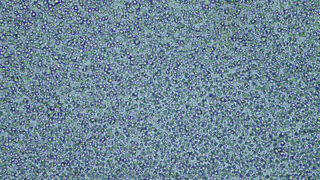 Breast milk under the microscope, woman lactating milk Feeding a baby. Protein and fatty acid lipids, with bacteria in human baby&rsquo;s milk. Microorganisms in milk under, with round bacteria, in America.