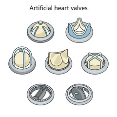 Artificial heart valve implant in human heart diagram schematic raster illustration. Medical science educational illustration