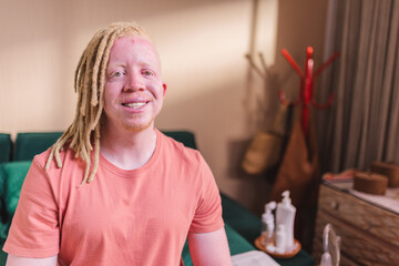 Albino man with dreadlocks, smiling, hands crossed, sitting on bed in the morning.