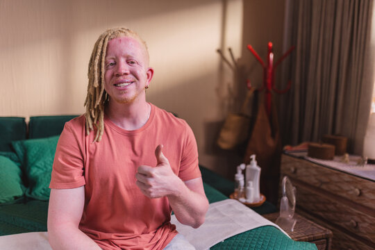Albino man smiling sitting on bed giving thumbs up sign.