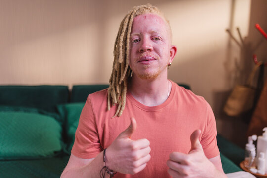 Homem albino sentado na cama dando sinal de positivo.