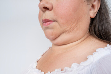 Double chin face mature woman 50 years old, human fat neck, side view, wrinkles on skin, facelift, age-related skin changes, aesthetic injection cosmetology, care anti-aging procedures