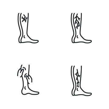 Varicose treatment icons, leg veins thrombosis disease and surgery vector symbols. 