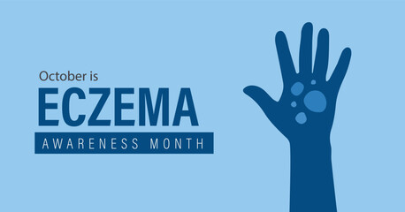 National Eczema Awareness Month banner. Observed in October annually. Flat vector design.