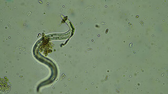 microorganisms close up under the microscope. in a soil sample from a farm