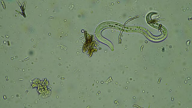soil sample containing soil biology, with bacteria, fungi, amoeba, flagellate, and arcella, on a sustainable agricultural farm in australia