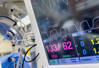 Hospital monitor displays vital signs: heart rate, blood pressure, and more. Symbolizes patient...