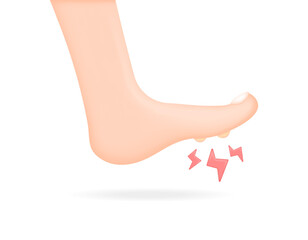 Clavus disease. There is a fisheye lump on the sole of the foot. nodules on the leg are painful or aching. health issues. Minimalist 3D illustration design. vector elements. white background © Papcut design 