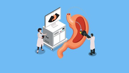 Gastroscopy Researching - gerd isometric cartoon animation in 4K UHD 3840x2160