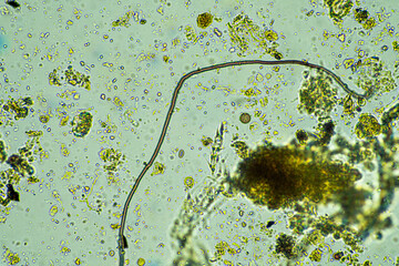 arcella, fungi and nematode in a soil sample on a farm