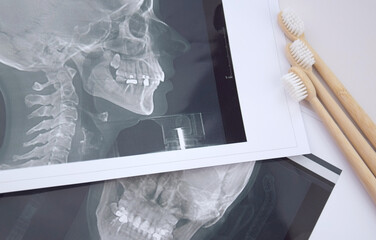 Panoramic snapshot of the jaw the patient's tooth.