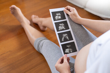 Asian Pregnant woman holding ultrasound photo. Concept of pregnancy, Maternity prenatal care. - obrazy, fototapety, plakaty