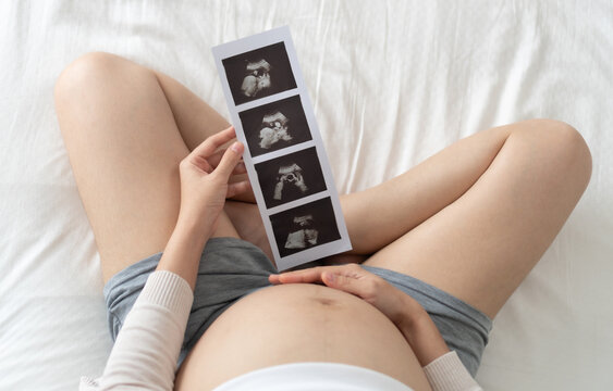 High angle view, Asian Pregnant woman holding ultrasound photo on bed. Concept of pregnancy, Maternity prenatal care. Top view