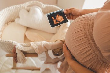 Ultrasound picture pregnant baby photo. Woman holding ultrasound pregnancy image. Concept of pregnancy, maternity, expectation for baby birth - obrazy, fototapety, plakaty