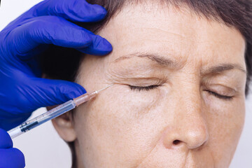 Doctor in blue gloves injecting fillers into facial wrinkles near eyes of elderly woman with syringe needle on white background. Face lift. Crow's feet. Correction with hyaluronic acid preparations 