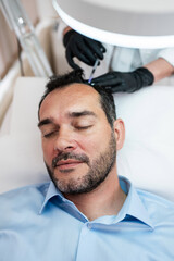 Handsome middle age man receiving advanced Platelet Rich Plasma PRP treatment against hair loss. Modern aesthetics treatments for males. Healthcare and beauty concept.