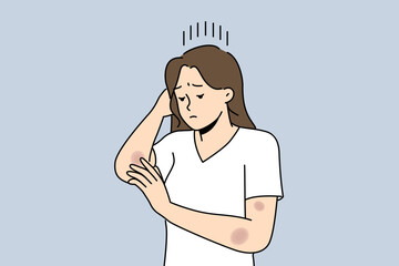 Woman with bruises on arms is sad and looks at abrasions received after fall or accident on road. Depressed girl needs healing ointment for bruises and wounds left due to domestic violence - obrazy, fototapety, plakaty