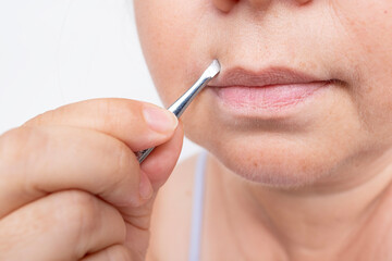 adult woman pulls out, removes with metal tweezers excess hairs on face near lips, close-up of...