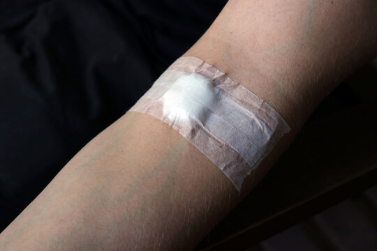pflaster in der armbeuge nach blutspende