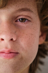 Crop crying boy with freckles on face skin