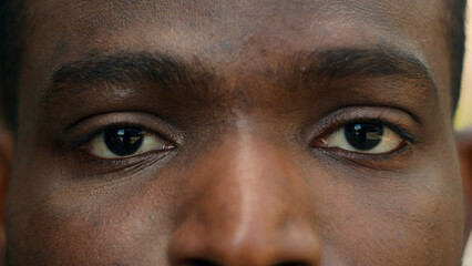 Close up cropped view detail ad male African American ethnic dark eyes close open blink ophthalmology eyesight see look vision sight eye problem strain ill sick facial expression looking laser surgery