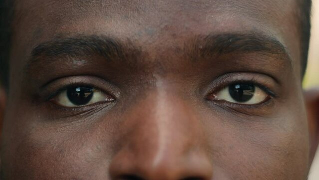 Close up cropped view detail ad male African American ethnic man dark eyes close open blink ophthalmology eyesight see look vision sight eye problem strain sick facial expression looking laser surgery