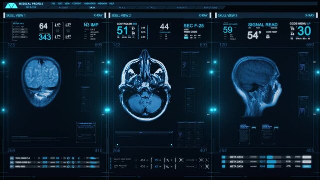 Futuristic Technological Interface Analyzing Human Brain Anatomy and Morphology. Medical Profile of Patient Showing, Brain lobes, Head MRI scan and Healthcare Data.
