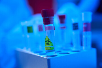 Special laboratory box with test tubes