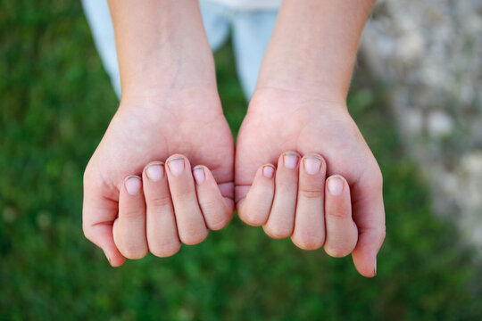 The child shows dirty nails.