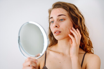 Beautiful woman with problematic skin works in her small mirror. Cosmetology. Skin care concept.