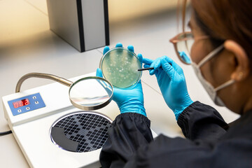 Scientist analysis and cultivate bacteria molds and fungal testing clinical samples, cultured in petri dish. Growth media to isolate total fungal by using colony counter in laboratory.