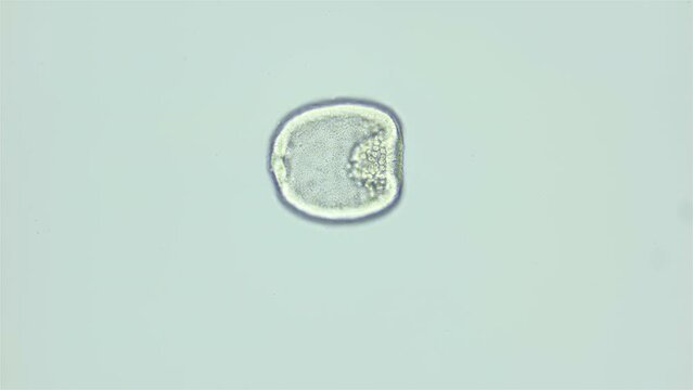Larva sea urchin Strongylocentrotus pallidus under microscope, phylum Echinodermata. Gastrula stage. White sea