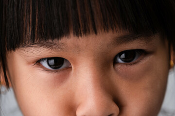 Beautiful eyes of a little Asian girl close-up. Headshot cropped image of a girl's eyes are angry expression. - obrazy, fototapety, plakaty