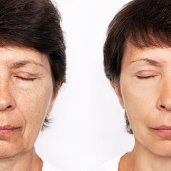 Elderly caucasian woman's face with puffiness under her eyes and wrinkles on eyelids, flabby...