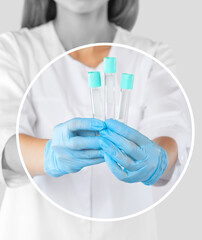 The doctor holds three tubes for collecting blood in his hands. Prp procedure in a beauty salon....