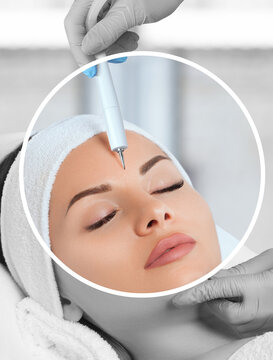 The cosmetologist makes the procedure treatment of Couperose and face cleaning of the skin of a beautiful, young woman in a beauty salon.Cosmetology and professional skin care.