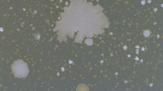 time lapse of growth of pathogenic bacteria on agar in a Petri dish