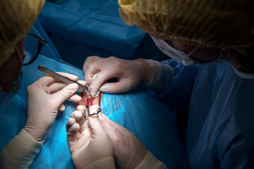 Rejuvenation and modification of the area around the eyes